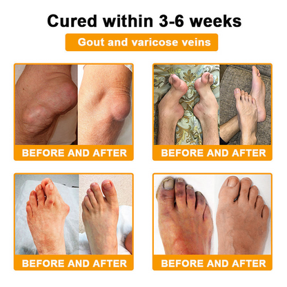 Purelora® Cream with Botulinum Toxin and Bee Venom for Pain Relief and Bone Regeneration