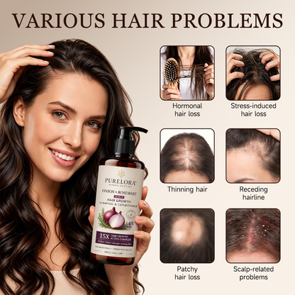 🌿👨‍⚕️ Official UK Flagship Store 🇬🇧 | 🔥PURELORA® Onion & Rosemary 2-in-1 Anti-Hair Loss & Growth Set — Infused with a 15x potent hair-growth active complex to help you achieve thicker, fuller, and stronger hair.