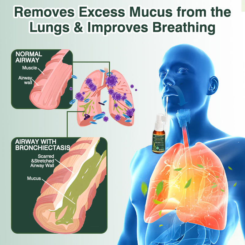 ✅ Official UK Flagship Store: Curalona® Mullein Leaf Extract Lung-Cleansing Spray (👨‍⚕️ Targets COPD, asthma, chronic bronchitis, respiratory infections, lung cancer, sinusitis, and other lung-related conditions)