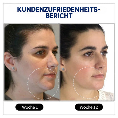 🔥 NUR HEUTE -80% RABATT 💎 MagneTech Magnetische Germanium-Ohrringe für Wellness & Komfort