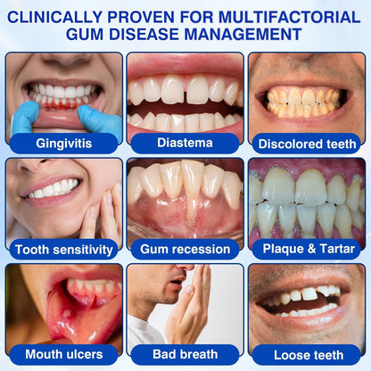 🇬🇧🦷Curalona® GumRevive Periodontal Repair Gel (For Bleeding Gums, Gum Recession & Loose Teeth)