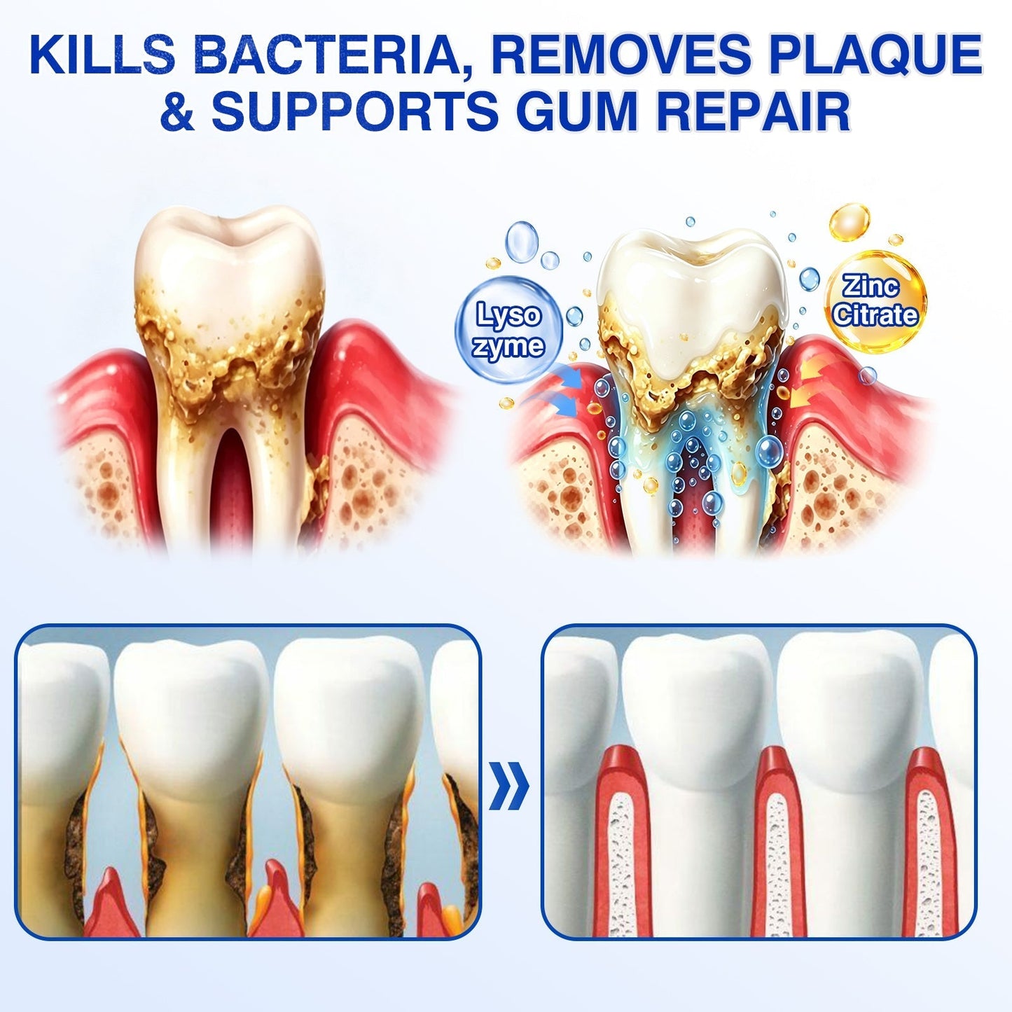 🇬🇧🦷Curalona® GumRevive Periodontal Repair Gel (For Bleeding Gums, Gum Recession & Loose Teeth)