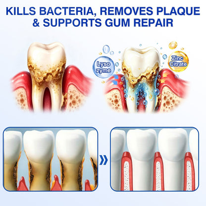 🇬🇧🦷Curalona® GumRevive Periodontal Repair Gel (For Bleeding Gums, Gum Recession & Loose Teeth)
