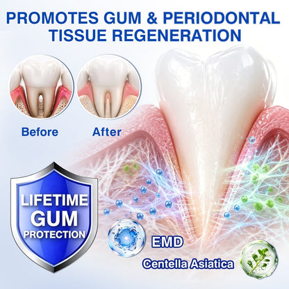 🇬🇧🦷Curalona® GumRevive Periodontal Repair Gel (For Bleeding Gums, Gum Recession & Loose Teeth)