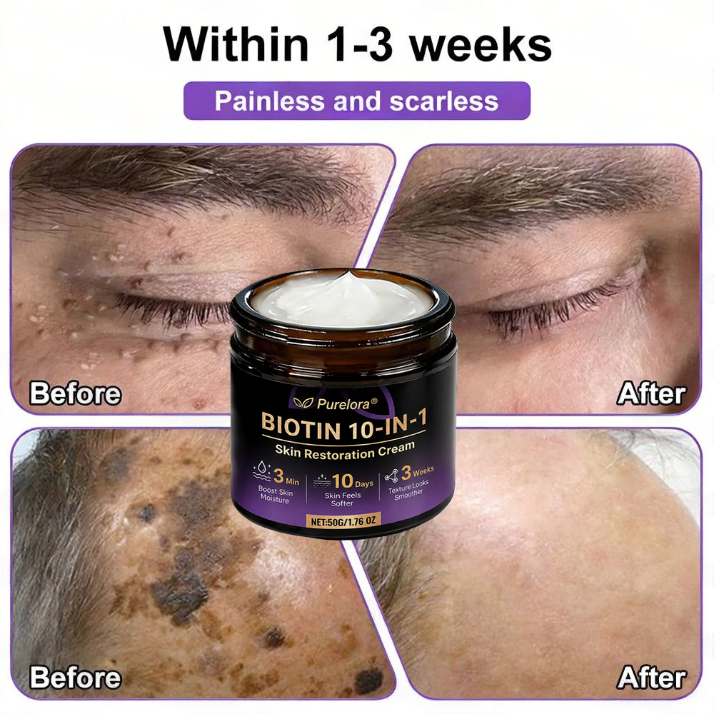 Made and Shipped from the UK 🍁 Purelora® Biotin 10-in-1 Skin Repair Cream — Last Day of Sale: 75% Off