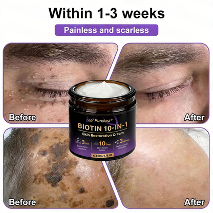 Made and Shipped from the UK 🍁 Purelora® Biotin 10-in-1 Skin Repair Cream — Last Day of Sale: 75% Off