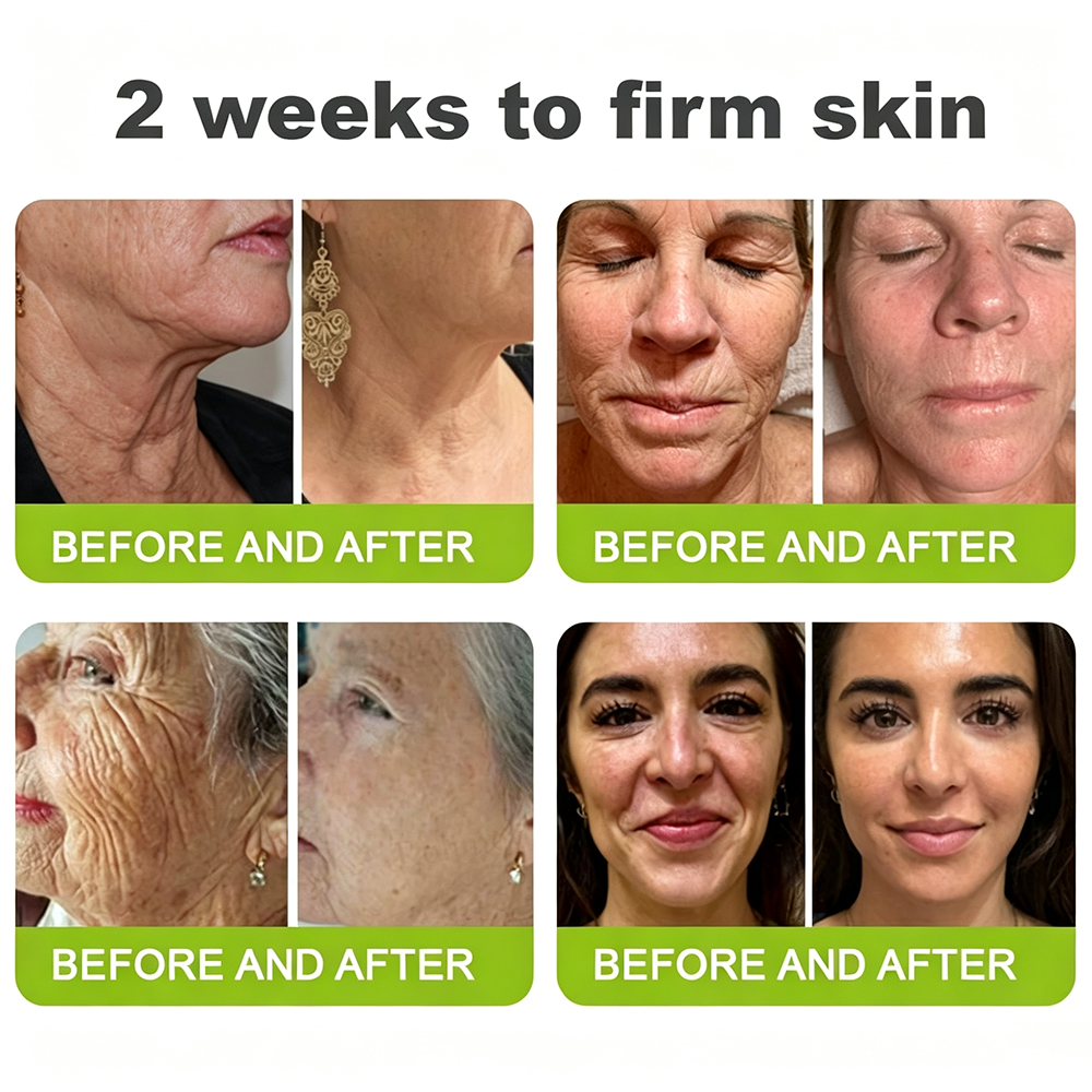 👍🌟🌿Curalona® Wrinkle-Lift Tightening cream - Last Day Promotion 70% OFF