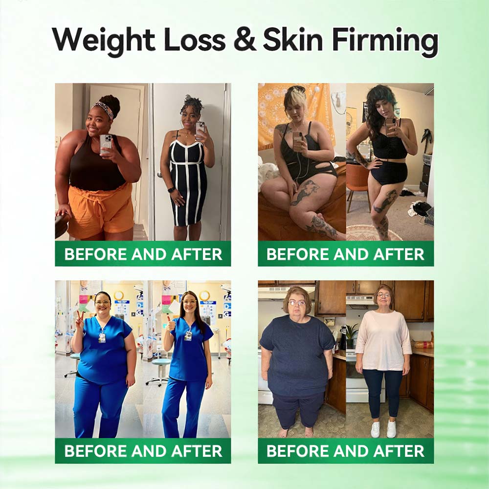 𝑶𝒇𝒇𝒊𝒄𝒊𝒂𝒍 𝑺𝒕𝒐𝒓𝒆  | 🌿curalona®𝑴𝒐𝒓𝒊𝒏𝒈𝗮 · 𝗕𝗲𝗿𝗯𝗲𝗿𝙞𝙣𝙚 × 𝙉𝘼𝐃+ 𝟏𝟎-𝐢𝐧-𝟏 𝗔𝗱𝘃𝗮𝗻𝗰𝙚𝙙 𝙉𝙖𝙣𝙤 𝙈𝙞𝙘𝙧𝙤𝙣𝙚𝙚𝐝𝐥𝐞 𝐏𝐚𝐭𝙘𝙝🇬🇧(𝐉𝐮𝐬𝐭 𝐨𝐧𝐜𝐞 𝐚 𝐝𝐚𝐲, 𝐯𝐢𝐬𝐢𝐛𝐥𝐞 𝐜𝐡𝐚𝐧𝐠𝐞𝐬 𝐢𝐧 𝟕 𝐝𝐚𝐲𝐬） ✅ 𝐅𝐨𝐫 𝐨𝐛𝐞𝐬𝐢𝐭𝐲, 🅛🅞🅞🅢🅔 🅢🅚🅘🅝,𝐝𝐢𝐚𝐛𝐞𝐭𝐞𝐬, 𝐬𝐥𝐞𝐞𝐩 𝐚𝐩𝐧𝐞𝐚, 𝐣𝐨𝐢𝐧𝐭 𝐢𝐬𝐬𝐮𝐞𝐬, 𝐚𝐧𝐝 𝐦𝐨𝐫𝐞