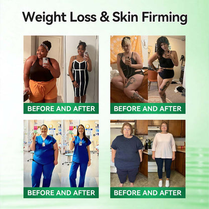 𝑶𝒇𝒇𝒊𝒄𝒊𝒂𝒍 𝑺𝒕𝒐𝒓𝒆  | 🌿curalona®𝑴𝒐𝒓𝒊𝒏𝒈𝗮 · 𝗕𝗲𝗿𝗯𝗲𝗿𝙞𝙣𝙚 × 𝙉𝘼𝐃+ 𝟏𝟎-𝐢𝐧-𝟏 𝗔𝗱𝘃𝗮𝗻𝗰𝙚𝙙 𝙉𝙖𝙣𝙤 𝙈𝙞𝙘𝙧𝙤𝙣𝙚𝙚𝐝𝐥𝐞 𝐏𝐚𝐭𝙘𝙝🇬🇧(𝐉𝐮𝐬𝐭 𝐨𝐧𝐜𝐞 𝐚 𝐝𝐚𝐲, 𝐯𝐢𝐬𝐢𝐛𝐥𝐞 𝐜𝐡𝐚𝐧𝐠𝐞𝐬 𝐢𝐧 𝟕 𝐝𝐚𝐲𝐬） ✅ 𝐅𝐨𝐫 𝐨𝐛𝐞𝐬𝐢𝐭𝐲, 🅛🅞🅞🅢🅔 🅢🅚🅘🅝,𝐝𝐢𝐚𝐛𝐞𝐭𝐞𝐬, 𝐬𝐥𝐞𝐞𝐩 𝐚𝐩𝐧𝐞𝐚, 𝐣𝐨𝐢𝐧𝐭 𝐢𝐬𝐬𝐮𝐞𝐬, 𝐚𝐧𝐝 𝐦𝐨𝐫𝐞