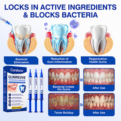 🇬🇧🦷Curalona® GumRevive Periodontal Repair Gel (For Bleeding Gums, Gum Recession & Loose Teeth)